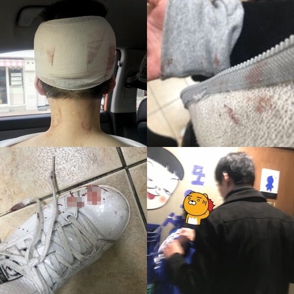 이수역 폭행 사건 (사진: 피해자 제공)