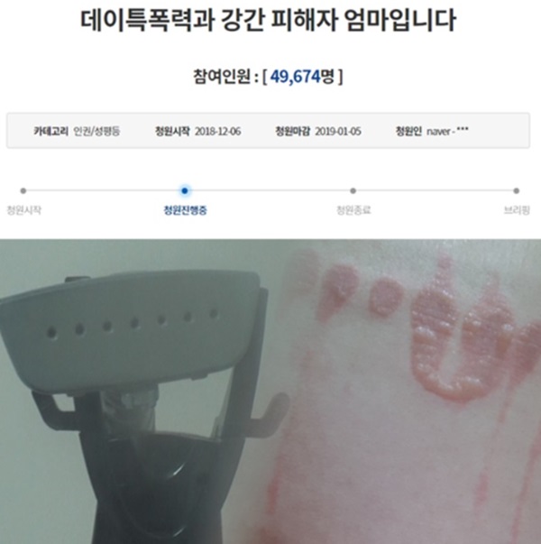 (사진: SBS '궁금한이야기Y')
