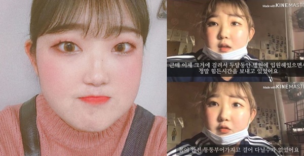 루푸스병 최준희 (사진: 최준희 SNS, 유튜브채널)