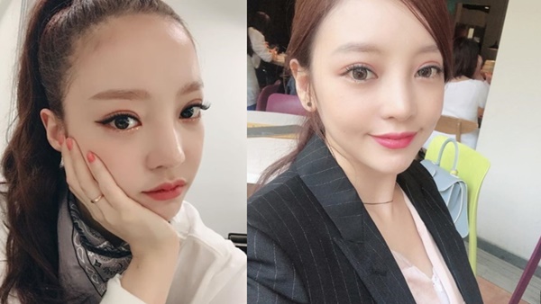 안검하수 구하라 (사진: 구하라 SNS)