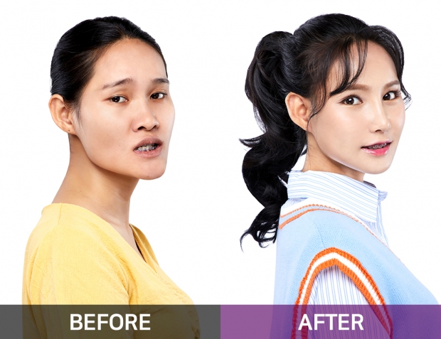 해외환자초청나눔의료