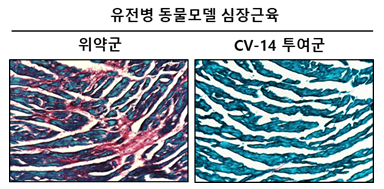 사진설명: 선천적 유전병 (비대성 심근증)에 걸린 시험동물에 위약 및 CV-14 단백질 제제를 투여한 후 심장 병리조직검사 결과 (붉은색: 심장근육의 경화 (cardiac fibrosis)로 인해 딱딱해지고 탄력을 잃음-심근증(cardiomyopathy)의 전형적인 특성, 파랑색: 정상 심장근육