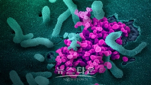 임상실험에서는 앞으로 18~55세의 건강한 사람 45명에 대해, 유효성분의 분량을 3가지 패턴으로 나누어 주사하고, 1인당 28일 간격으로 2회 투여, 안정성 등을 확인하는 과정을 거칠 방침이라고 한다. (사진 : NIH)