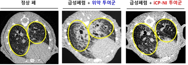 사진설명: 급성폐렴에 걸린 실험동물의 폐 염증 (섬유화) 치료효과 CT 사진 (왼쪽: 정상, 가운데: 폐렴+위약군, 오른쪽: 폐렴+iCP-NI 투여군)