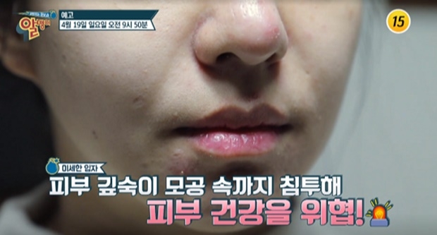 (사진: TV조선 ‘팡팡터지는 정보쇼 알맹이’)