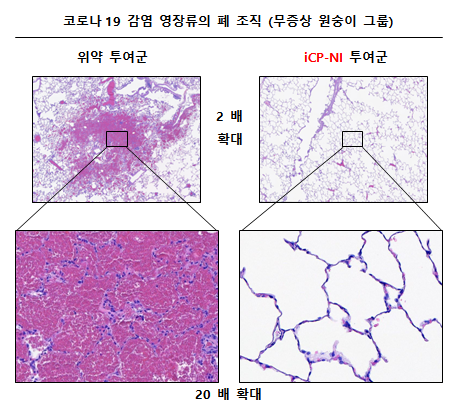 사진설명: 코로나19 감염 영장류 (무증상)의 폐 조직에서 출혈 (hemorrhage)이 일어나 폐포(alveolar) 내부에 적혈구가 가득 찬 반면, iCP-NI를 투여한 영장류에서는 폐 조직 손상이 치료되었음