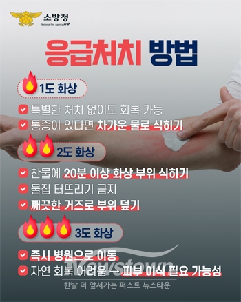 화상 응급처치 요령